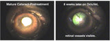 OcluVet Eye drops